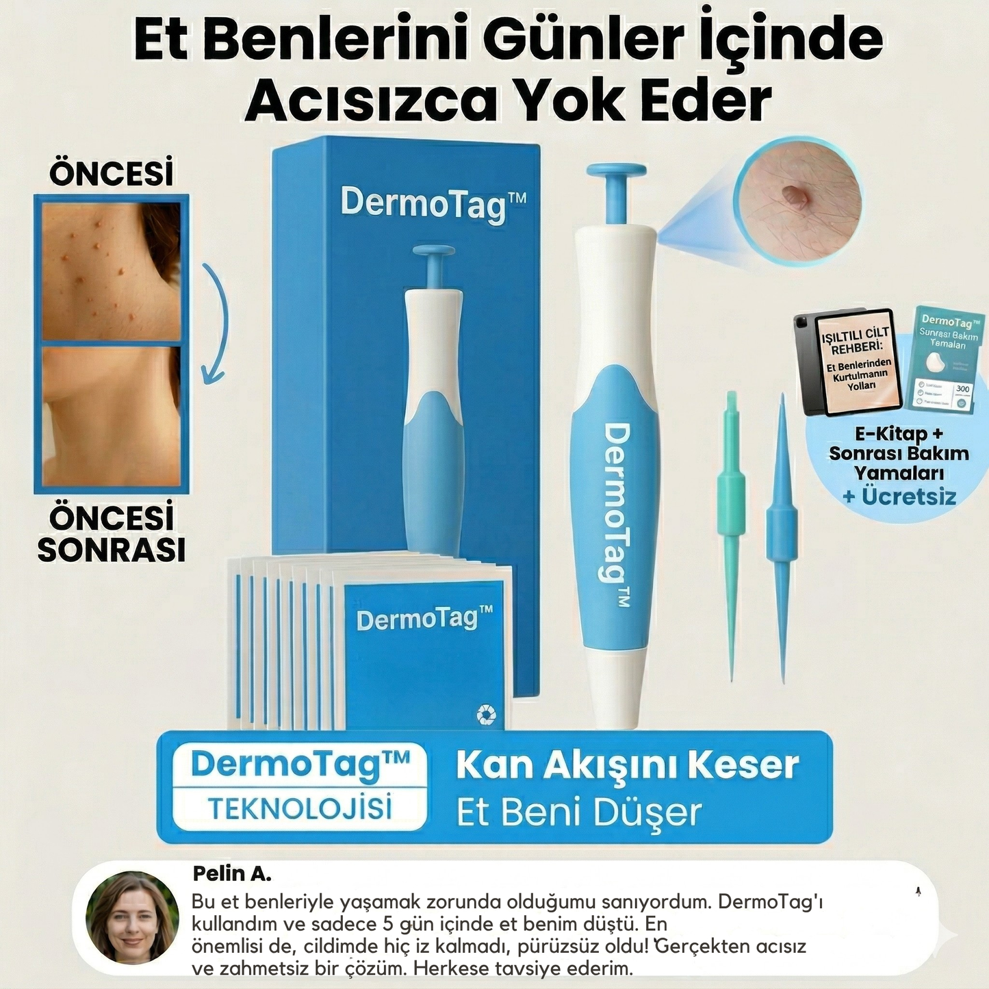 DermoTag™ Profesyonel Et Beni Giderici Kit